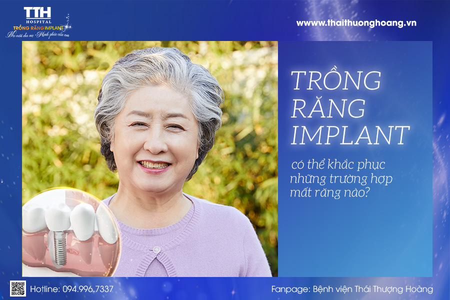 Trồng răng Implant có thể khắc phục những trường hợp mất răng nào?